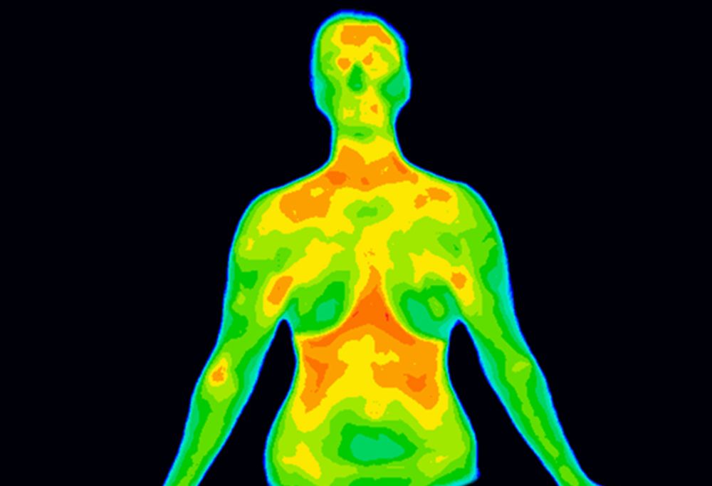 thermography